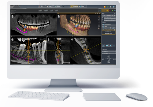 products_implantology_software_header2
